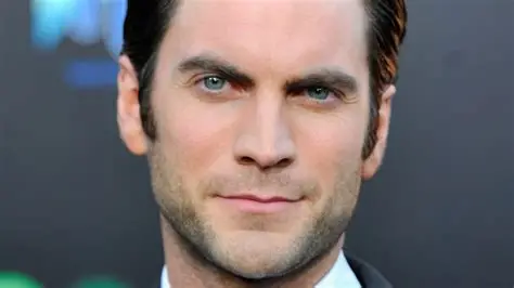 The Evolution of Wes Bentley’s Smile: A Deep Dive into His Dental Journey